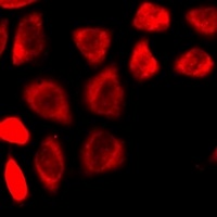 Anti-NMT2 Antibody