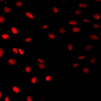 Anti-HAND2 Antibody
