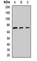 PKC nu Rabbit Polyclonal Antibody