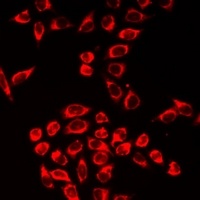 Grancalcin Antibody