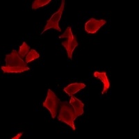 Anti-LDLRAP1 Antibody