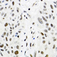 Anti-TRMT2A Antibody