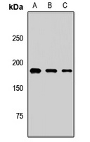 ALS2CR6 Rabbit Polyclonal Antibody