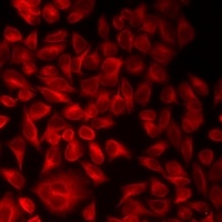 Anti-ALS2CR6 Antibody