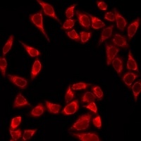 Anti-THADA Antibody