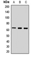 PINK1 Rabbit Polyclonal Antibody