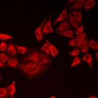 PINK1 Rabbit Polyclonal Antibody