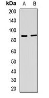NOX5 Rabbit Polyclonal Antibody