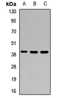 PTCRA Rabbit Polyclonal Antibody