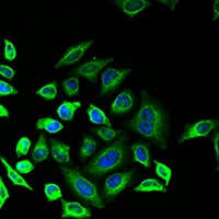 Anti-PLA2G2D Antibody