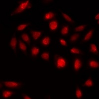 Anti-KLF3 Antibody