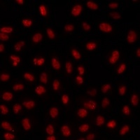 Anti-PHIP Antibody