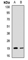 SSAT2 Rabbit Polyclonal Antibody