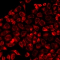 Anti-SSAT2 Antibody