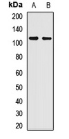 TAF5 Rabbit Polyclonal Antibody