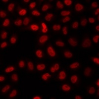 Anti-TAF5 Antibody