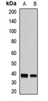 TOB2 Rabbit Polyclonal Antibody