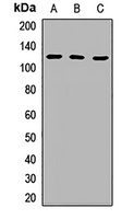 RAP80 Rabbit Polyclonal Antibody