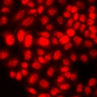 Anti-RAP80 Antibody