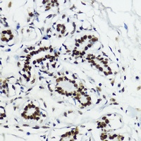 Anti-Histone H3 (Acetyl-K27) Antibody