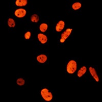 Anti-Histone H3 (Acetyl-K27) Antibody