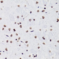 Histone H3 (Acetyl-K18) Antibody