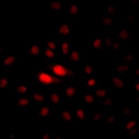 Anti-NAT10 Antibody