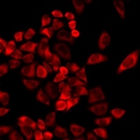 Anti-TMLHE Antibody