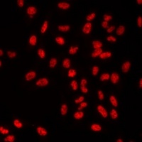 ETS2 Antibody
