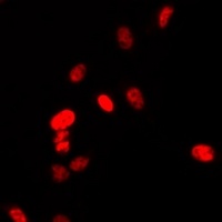 PAX6 Rabbit Polyclonal Antibody
