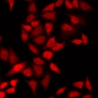 Anti-CSRP2BP Antibody