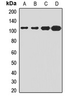 FASTKD1 Rabbit Polyclonal Antibody