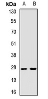 NAT-15 Rabbit Polyclonal Antibody