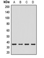 CHMP4B Rabbit Polyclonal Antibody