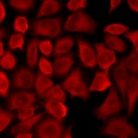 Anti-Pancreatic Lipase Antibody