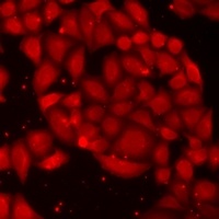 Anti-PIP4K2 alpha Antibody