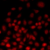 Anti-TEAD3 Antibody