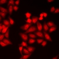 Anti-BRK Antibody