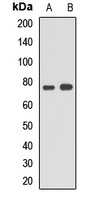 ACSL5 Antibody