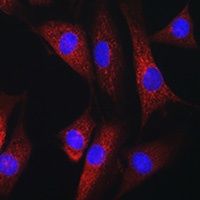 RAB1B antibody