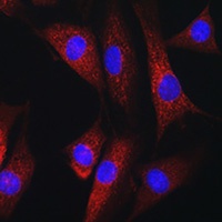 Anti-RAB1B Antibody