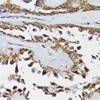 Anti-TARBP2 Antibody