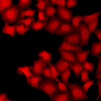 Anti-TARBP2 Antibody