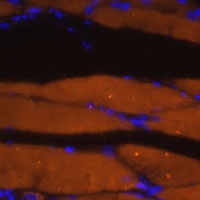 Anti-Myosin 7 Antibody