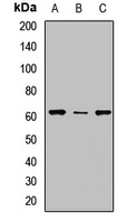 UGT2B10 Rabbit Polyclonal Antibody