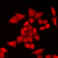 Anti-TLF Antibody