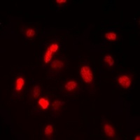 Anti-FANCM Antibody