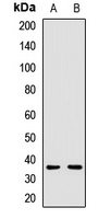 TSARG2 Antibody