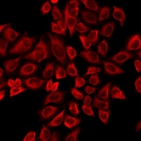 Anti-TTBK2 Antibody