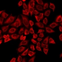 TTBK2 antibody